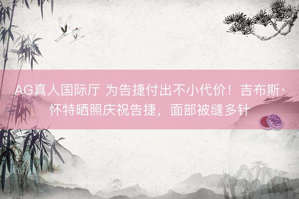 AG真人国际厅 为告捷付出不小代价！吉布斯·怀特晒照庆祝告捷，面部被缝多针